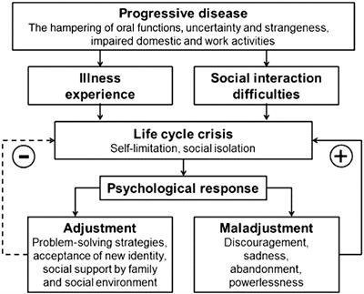 An Update on the Lived Experience of Dry Mouth in Sjögren's Syndrome Patients